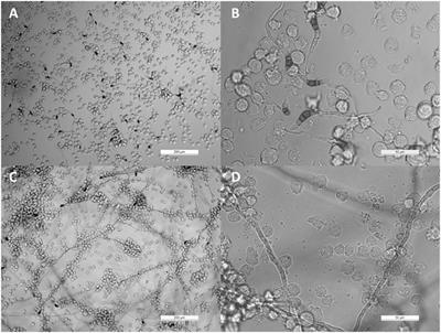 Interaction of THP-1 Monocytes with Conidia and Hyphae of Different <mark class="highlighted">Curvularia</mark> Strains